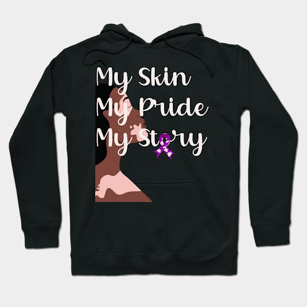 Black Woman with Vitiligo My Skin My Pride My Story Vitiligo Awareness and Acceptance Hoodie by Mind Your Tee